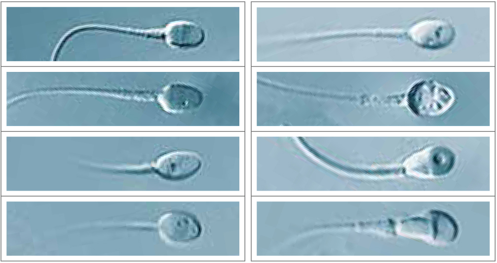 spermiogram